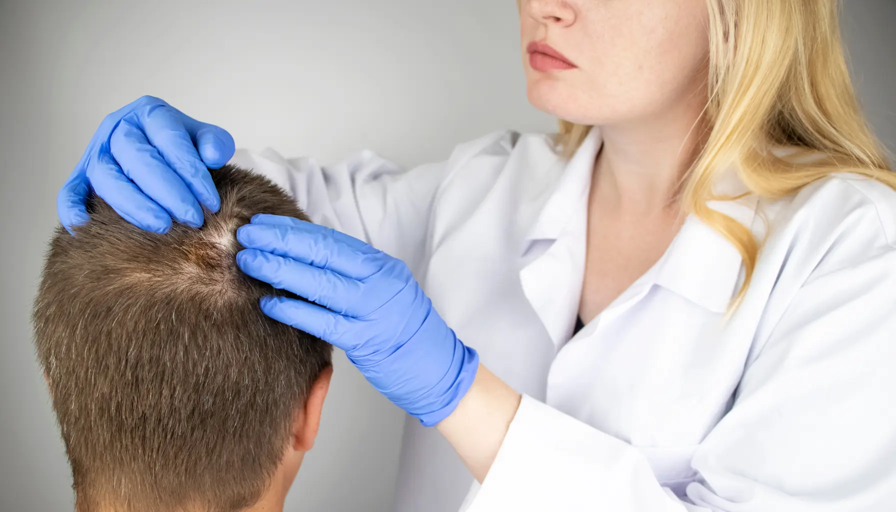 Dermatologist examining a patient's scalp