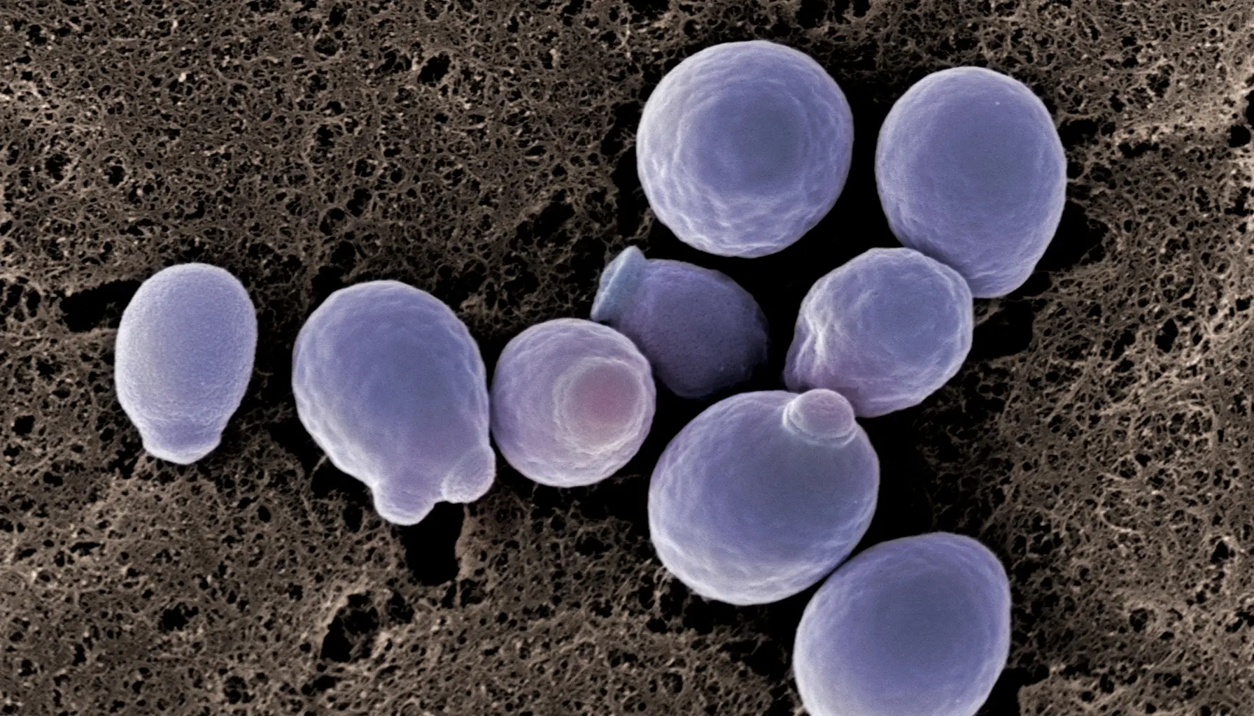 Illustration of malassezia yeast causing fungal acne