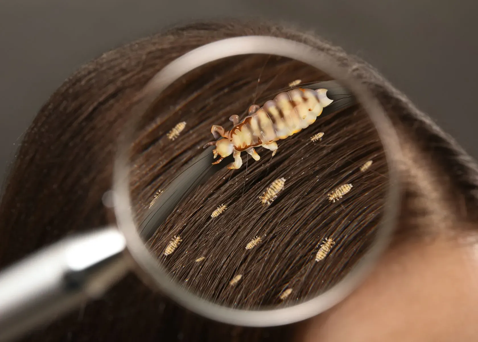 What Are Head Lice and Nits?
