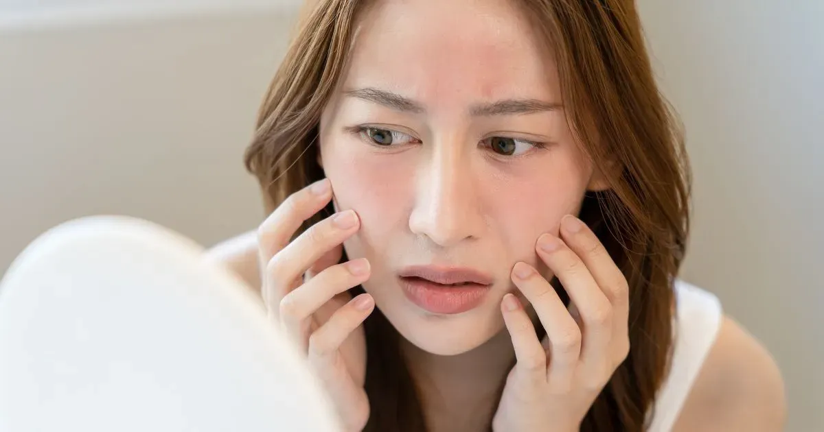 Moisturizer for Dry Skin - 7 Reasons Why It Stings