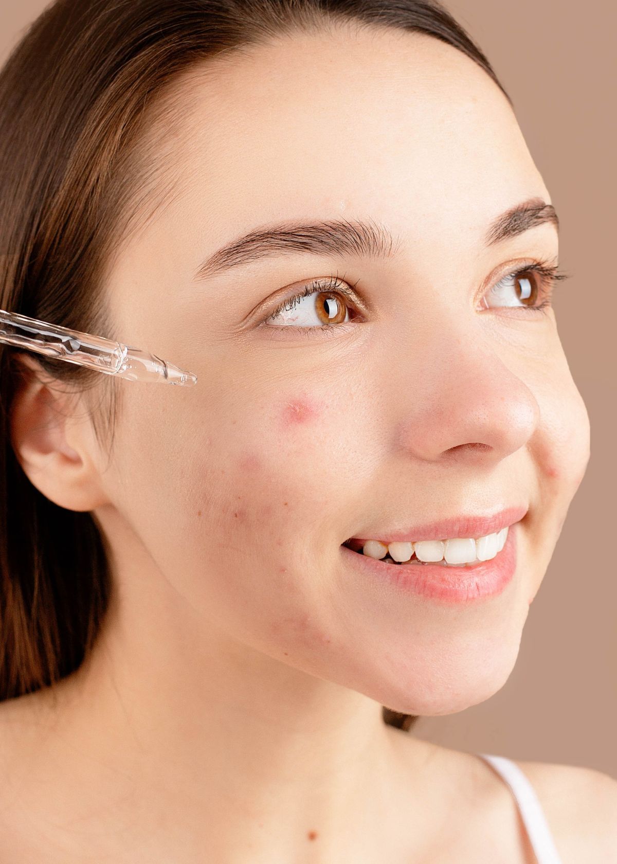 Is Vitamin C Good for Acne-Prone Skin? Unravel the Truth