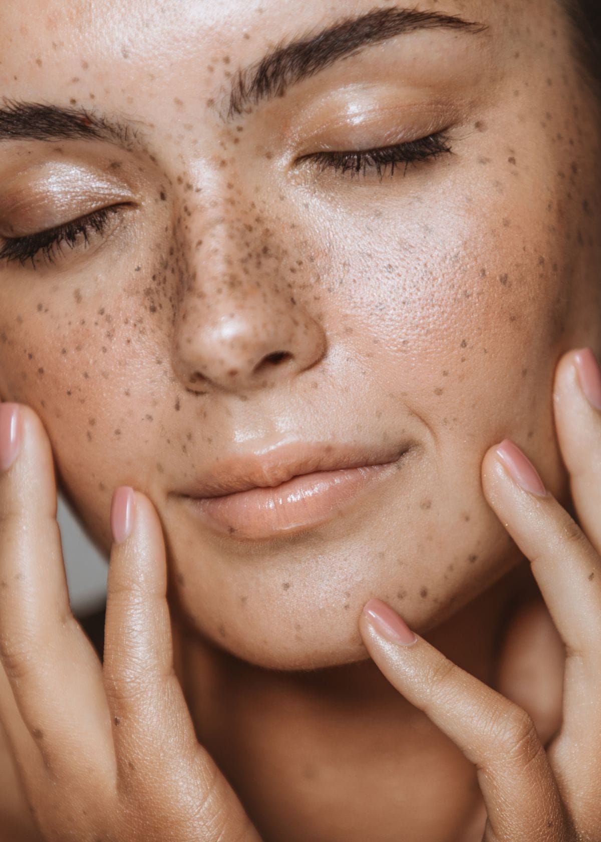 Unmasking Hyperpigmentation: Causes, Treatments, and Prevention