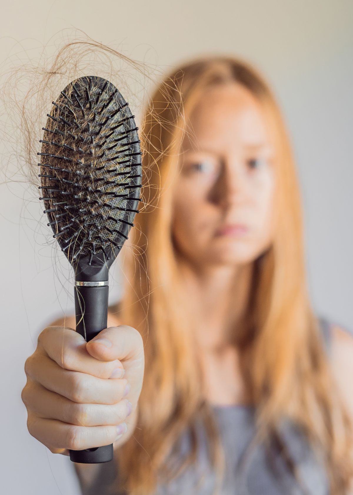 Hair Today, Gone Tomorrow: A Teen's Guide to Understanding Hair Loss