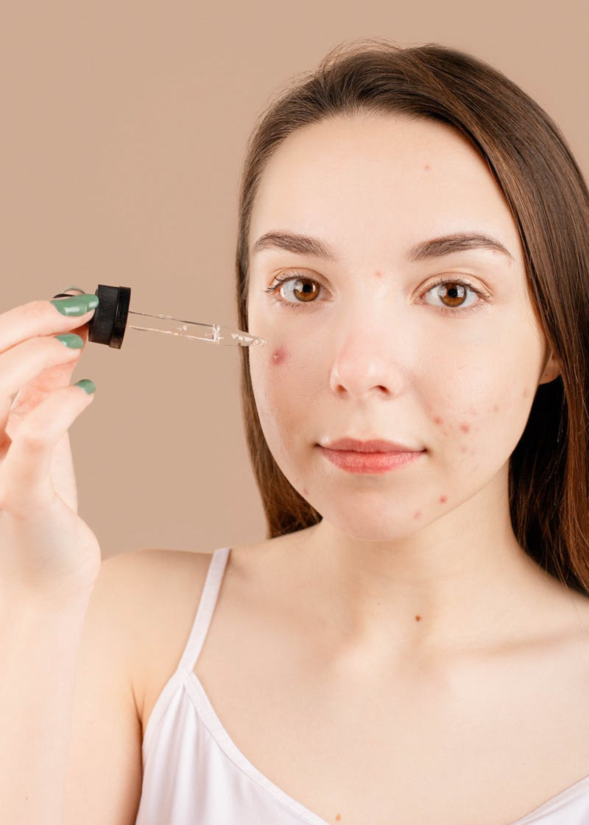 Best Serum For Acne Scars: 5 Brands that Work!