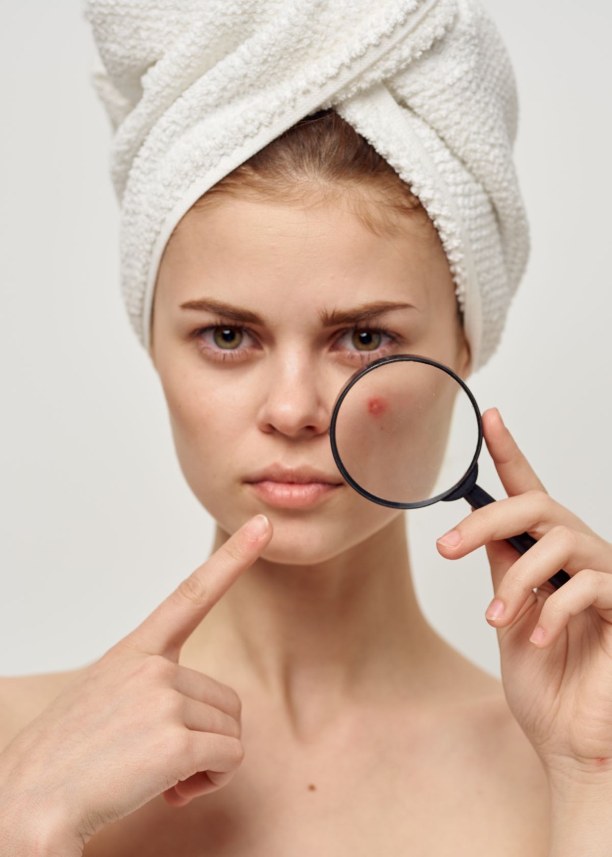 Does Hyaluronic Acid Help Acne Scars?